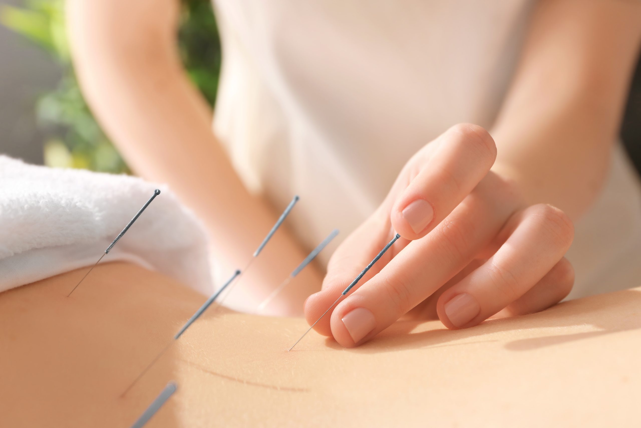 Power of Fertility Acupuncture