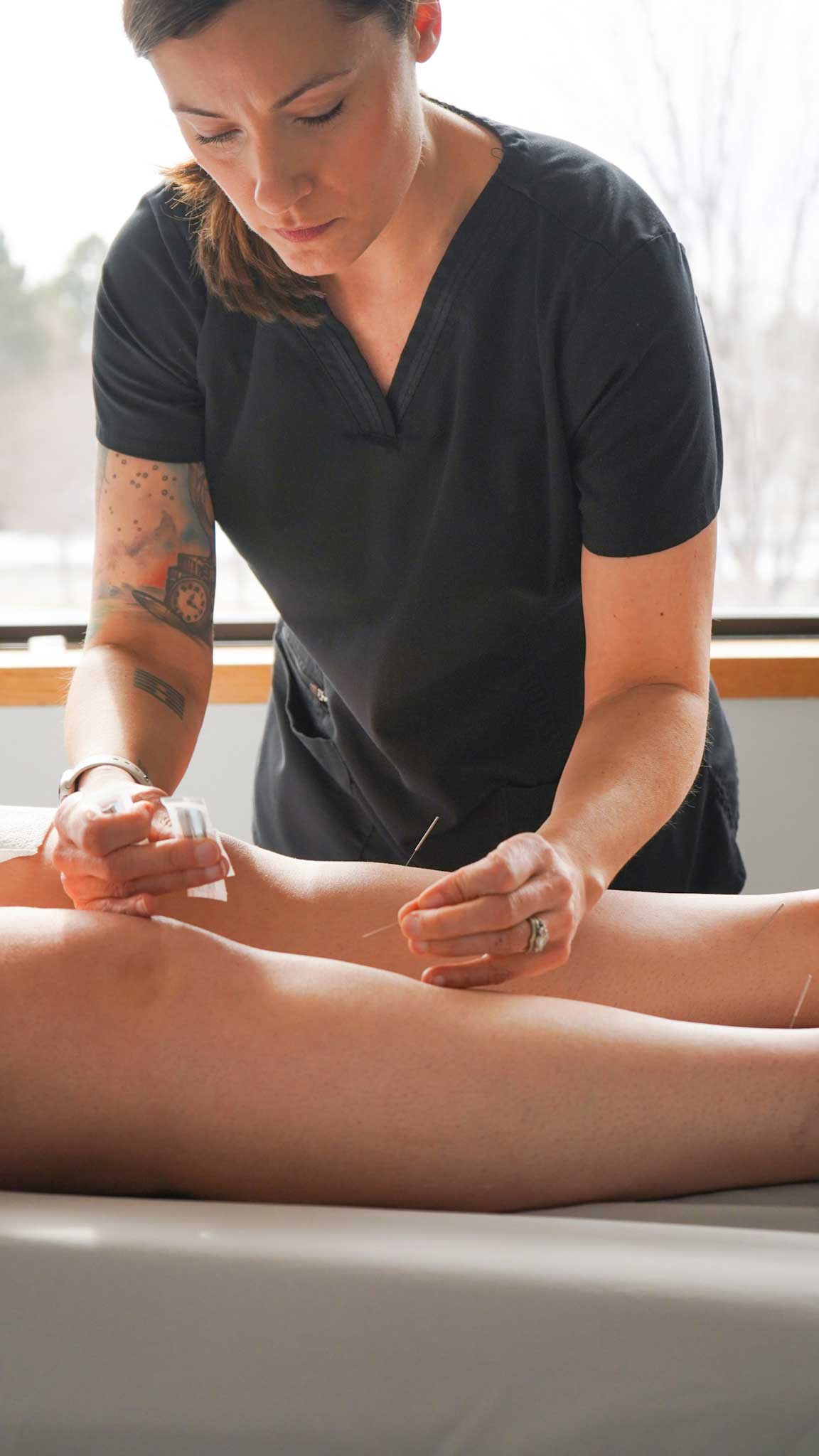 Cheryl performing acupuncture on a patients legs in her office